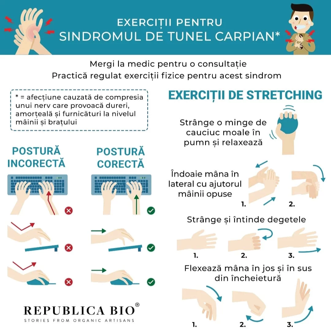 Sindromul de tunel carpian